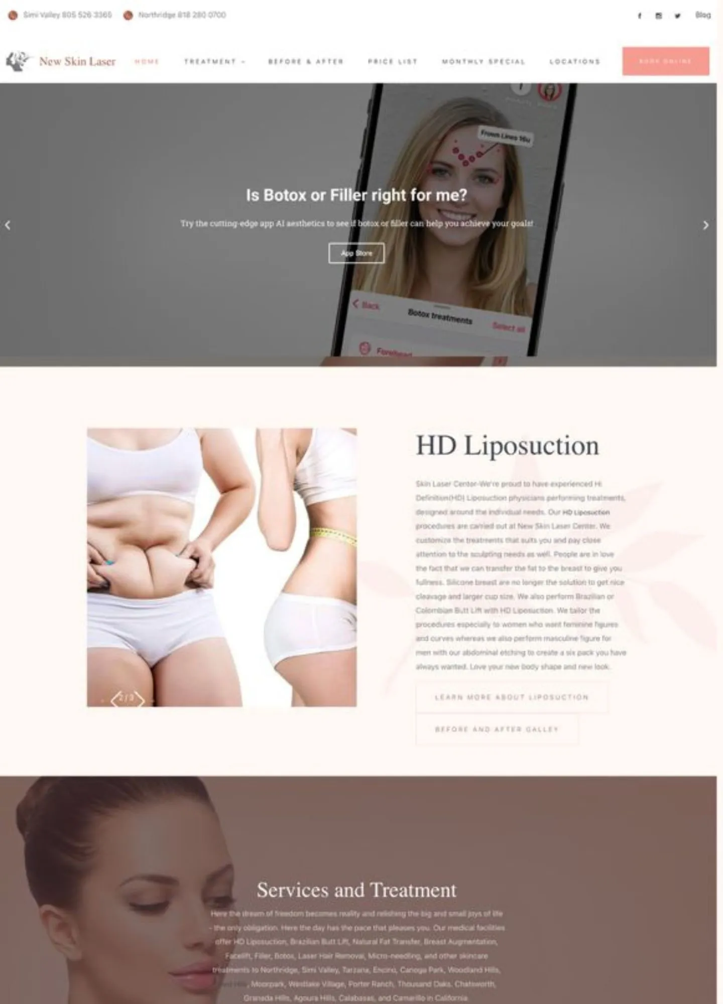 Cosmetic clinic website with an HD liposuction service section
